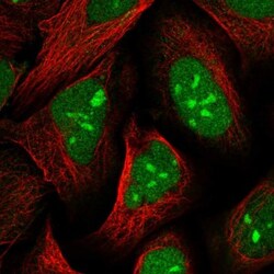 UBLCP1 Antibody, Novus Biologicals 0.1mL; Unlabeled:Antibodies, Polyclonal
